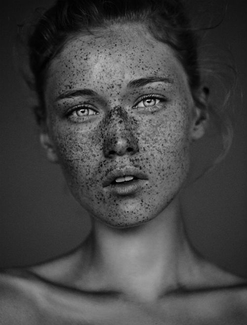 carsten_witte_the_freckles_project_01_coultique